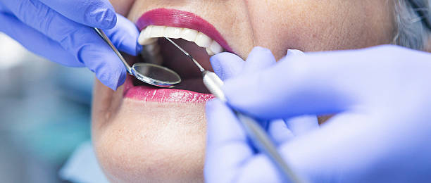 Best Emergency Dentist for Knocked-Out Tooth in Waldpt, OR